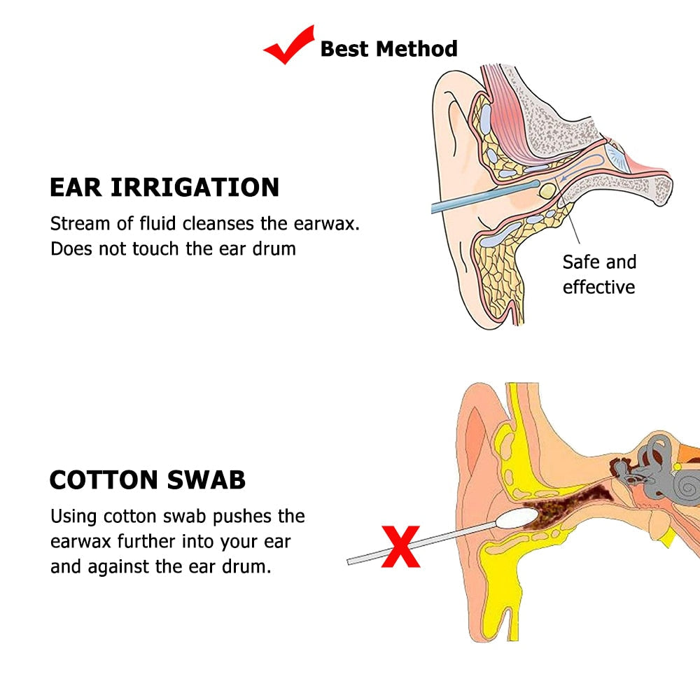Professional Ear Cleaner Ear Irrigator D818